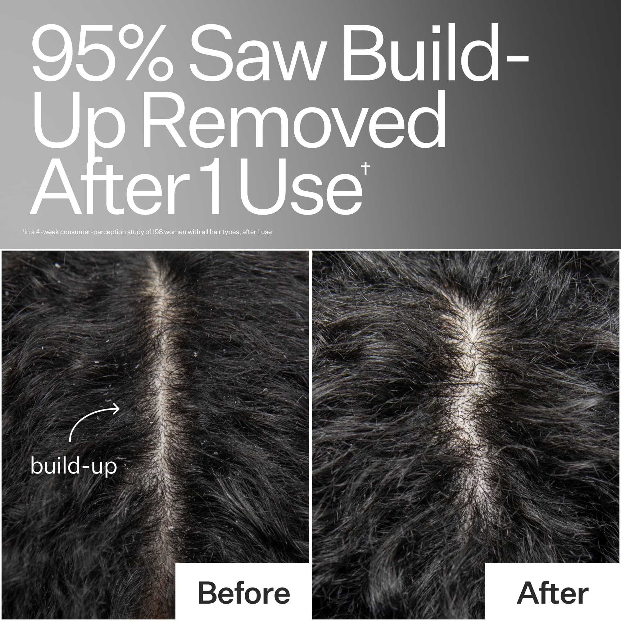 Scalp Detox Oil - Image 3