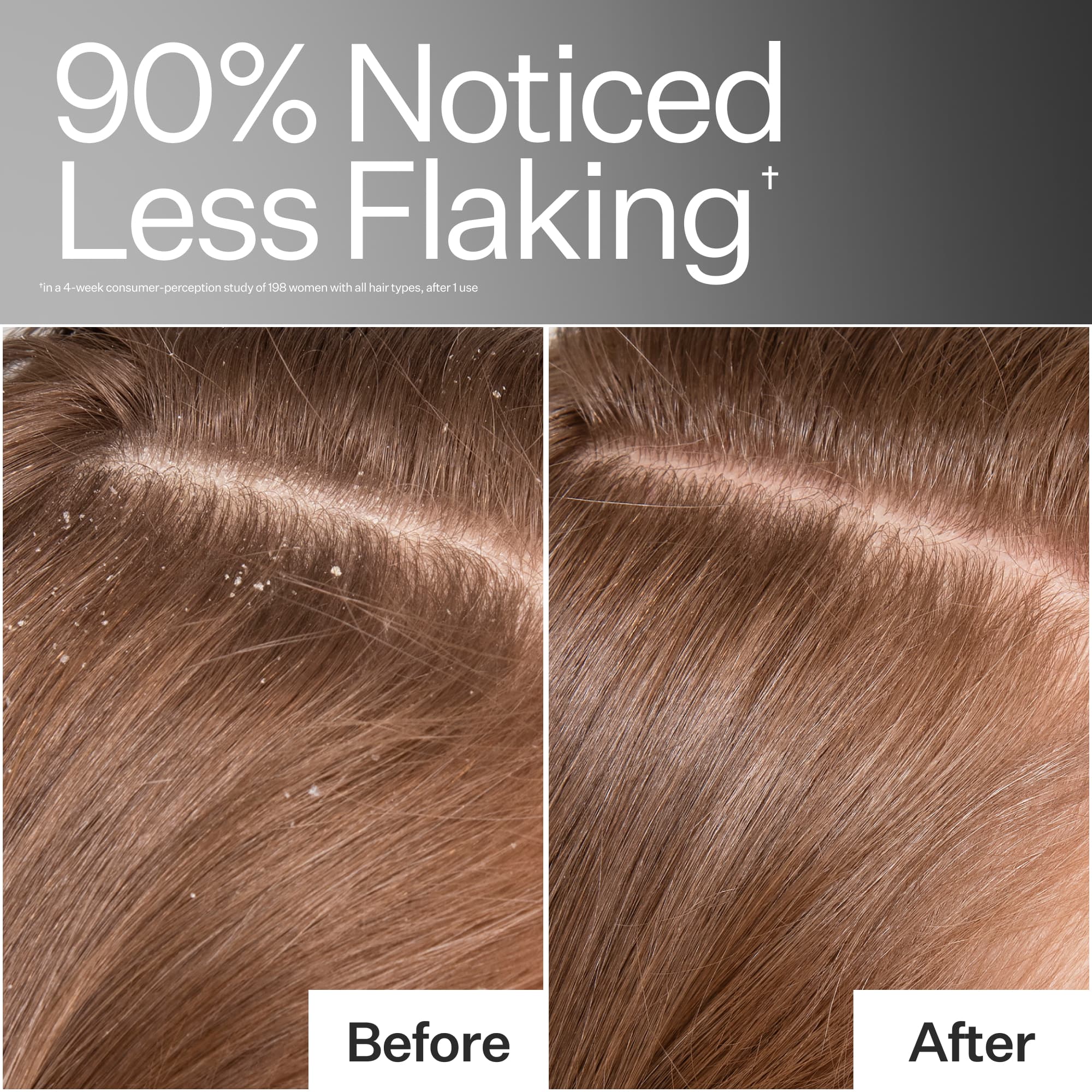 Scalp Detox Oil - Image 4