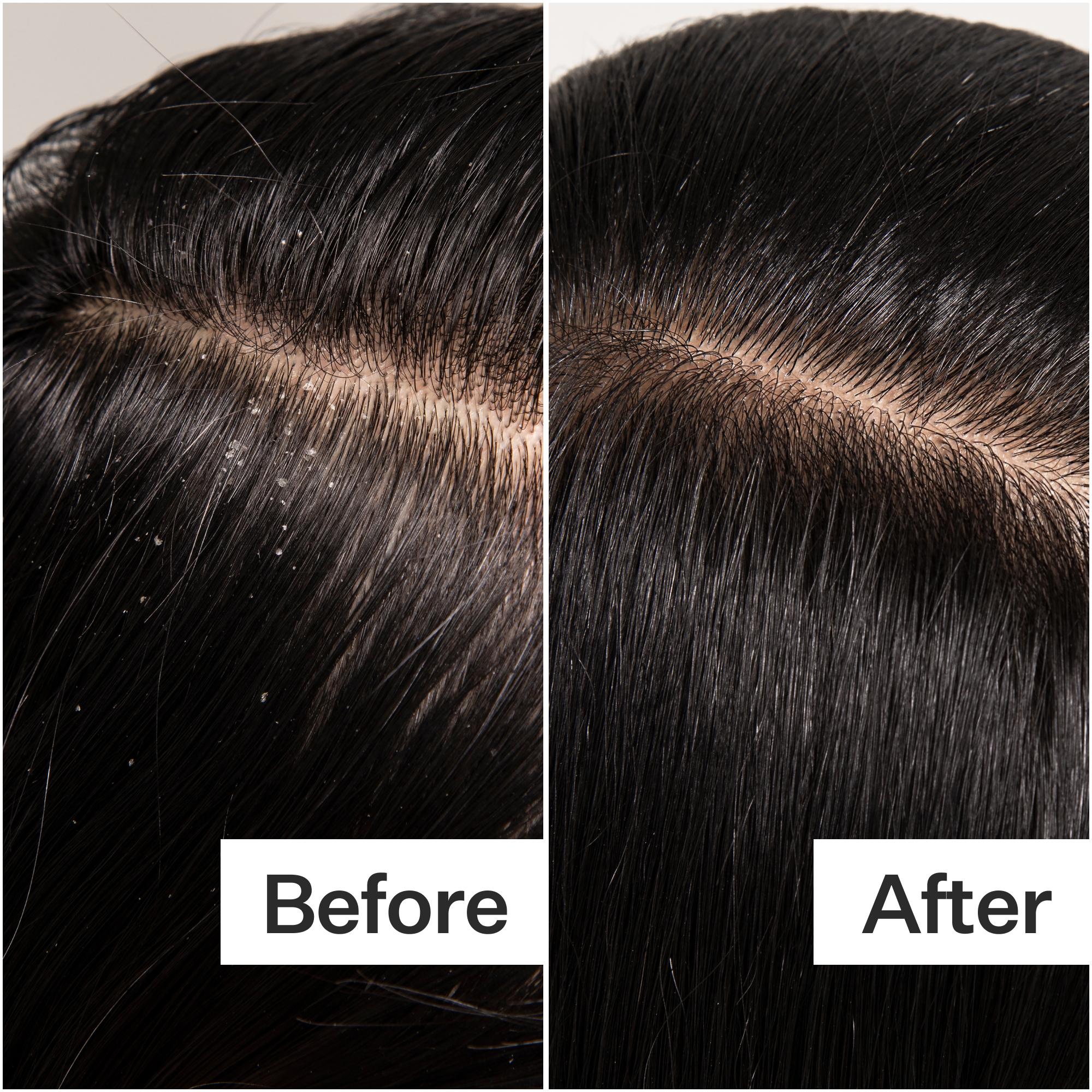 Scalp Detox Oil - Image 6