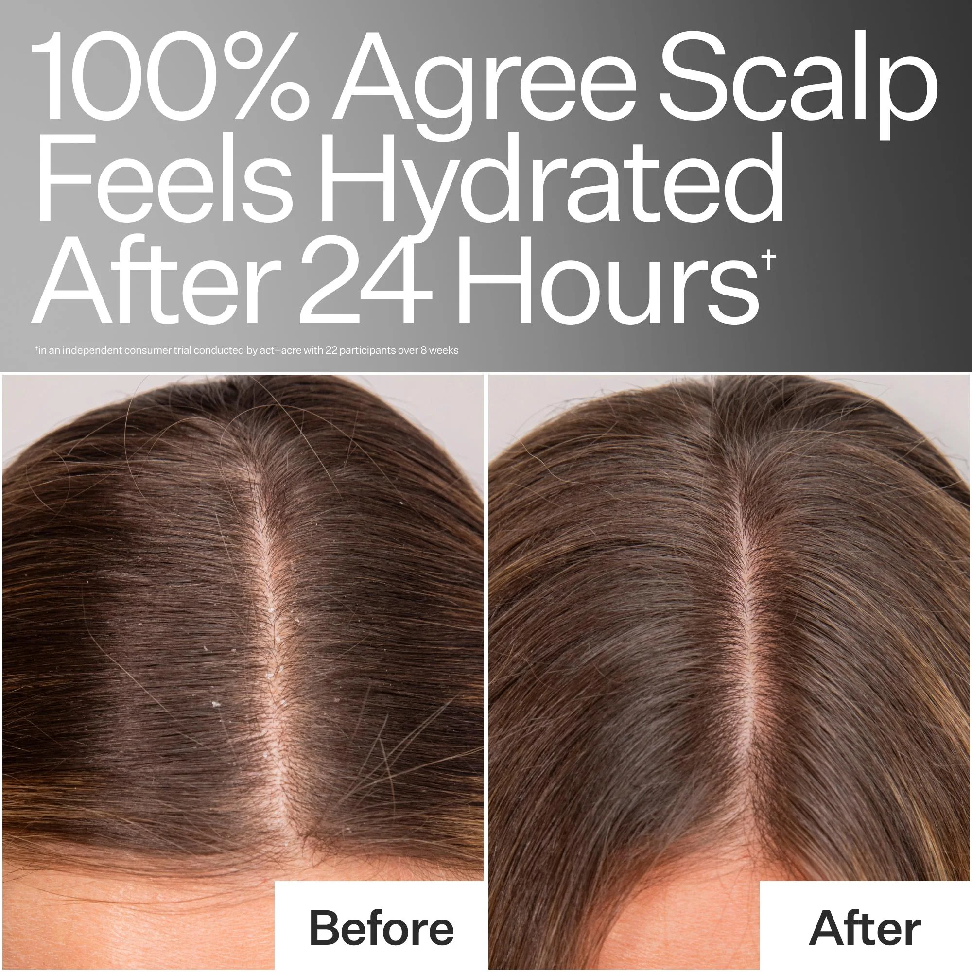 Daily Hydro™ Scalp Serum - Image 10