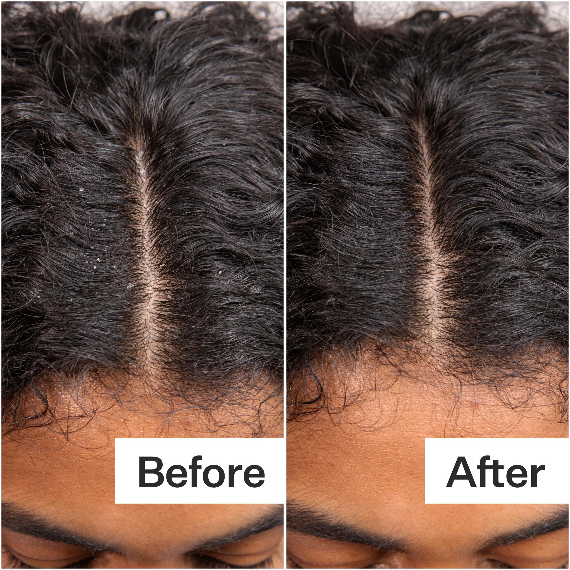 Daily Hydro™ Scalp Serum - Image 11