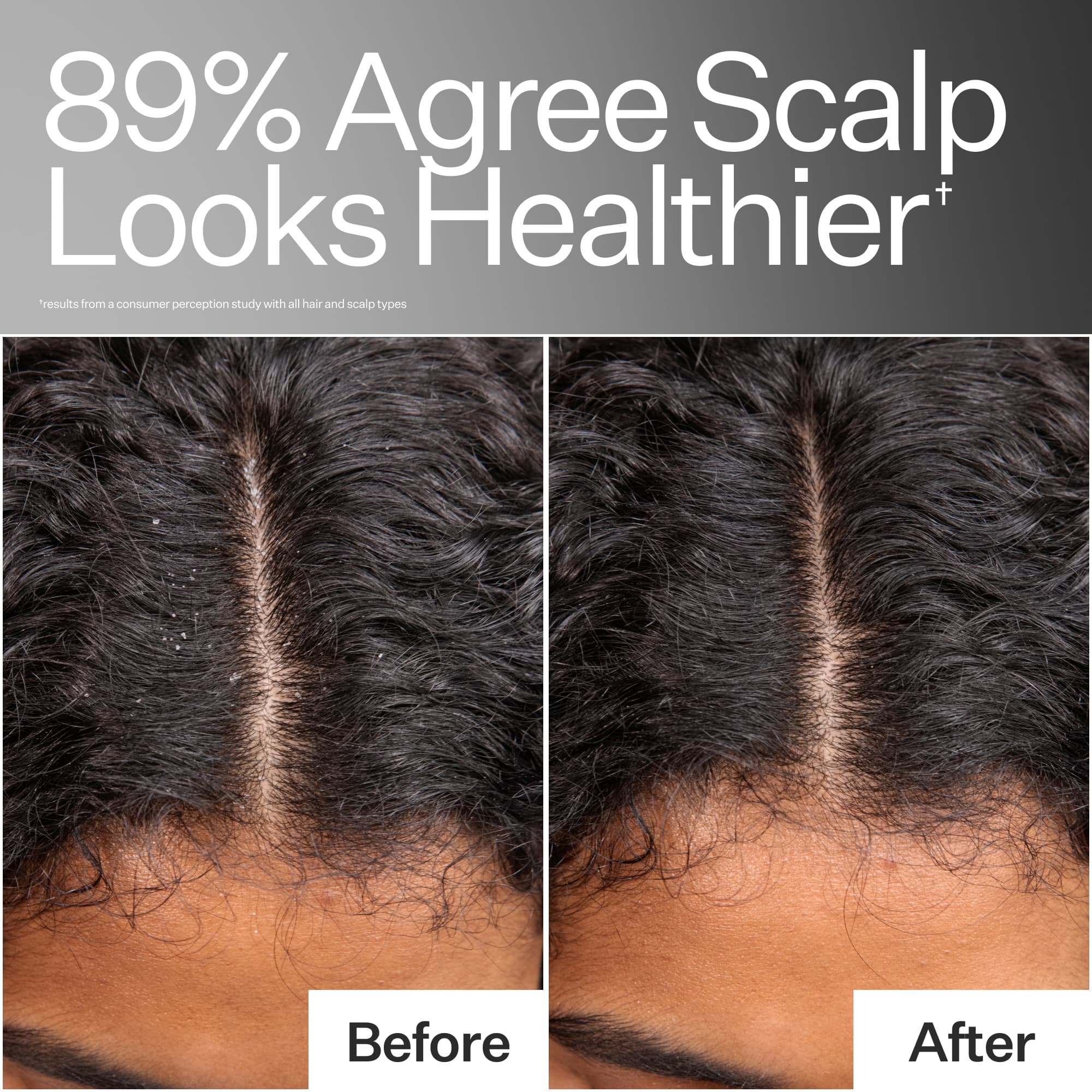 Instant Scalp Relief Pro System - Image 3