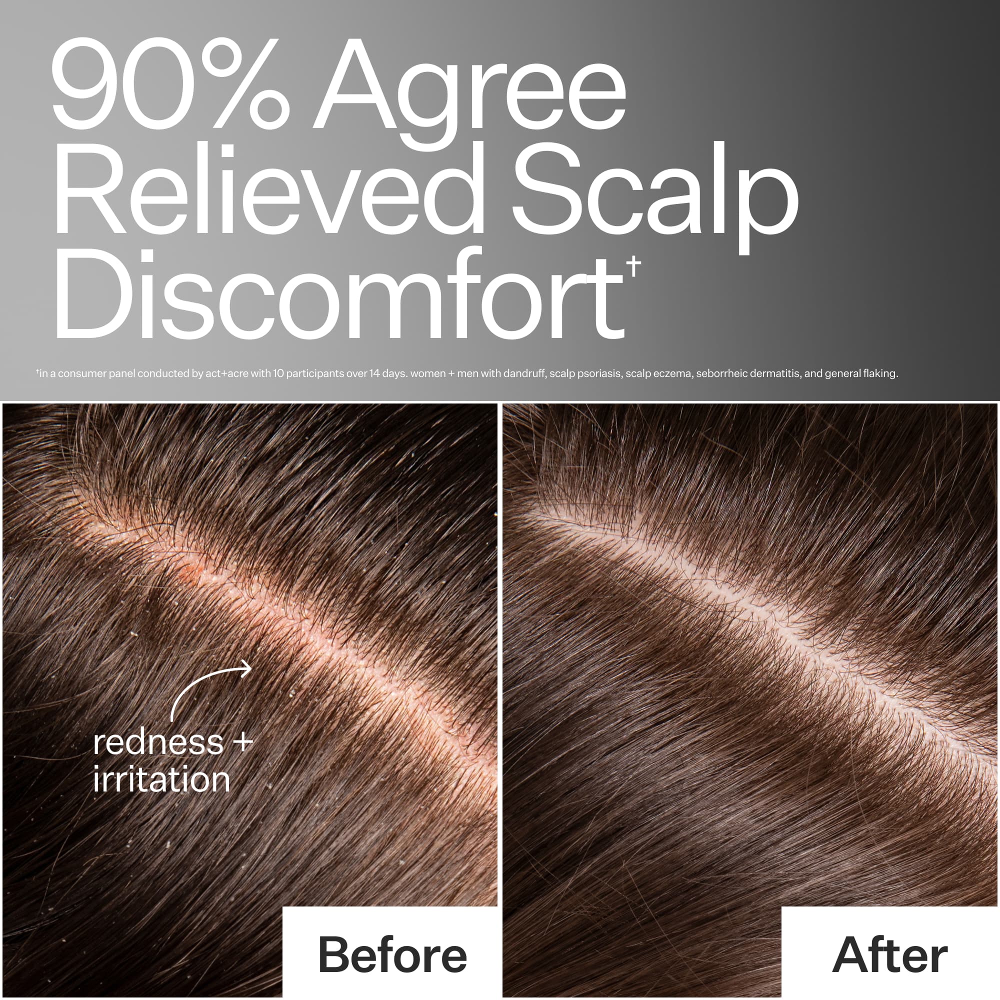 Scalp Relief Cooling Serum - Image 3
