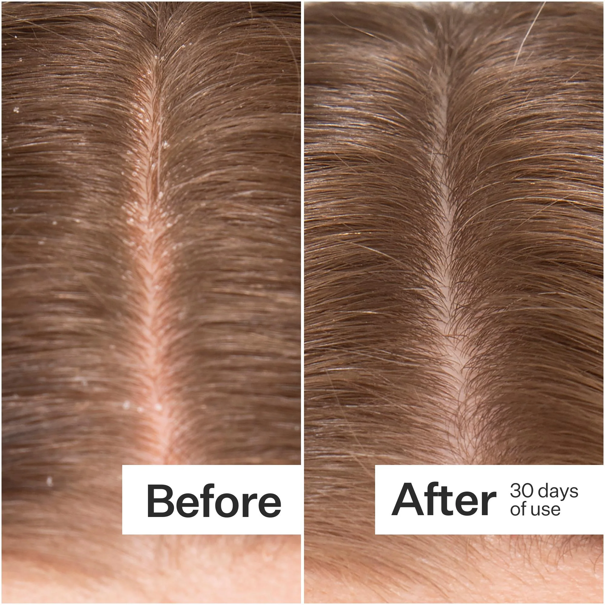 Scalp Relief Cooling Serum - Image 4