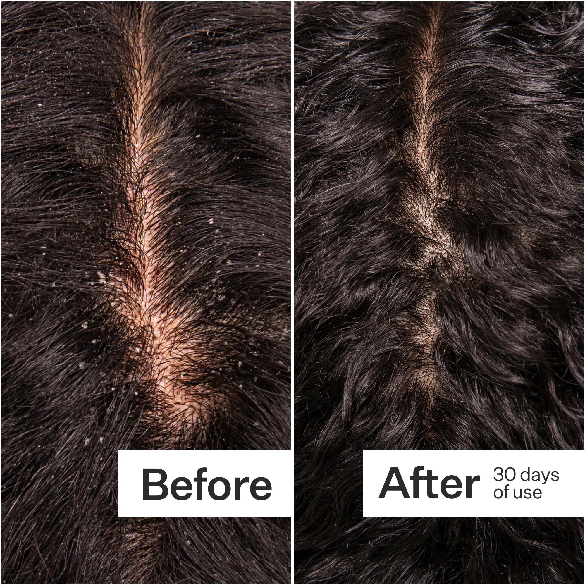 Scalp Relief Cooling Serum - Image 5