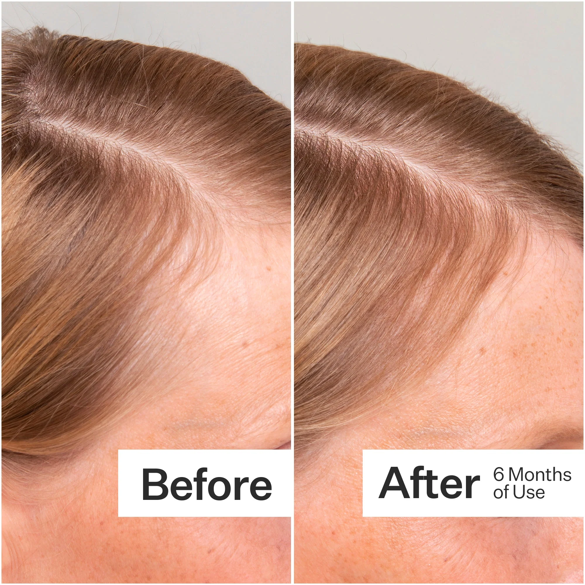 Stem Cell Scalp Serum for Thicker, Fuller Looking Hair - Image 4