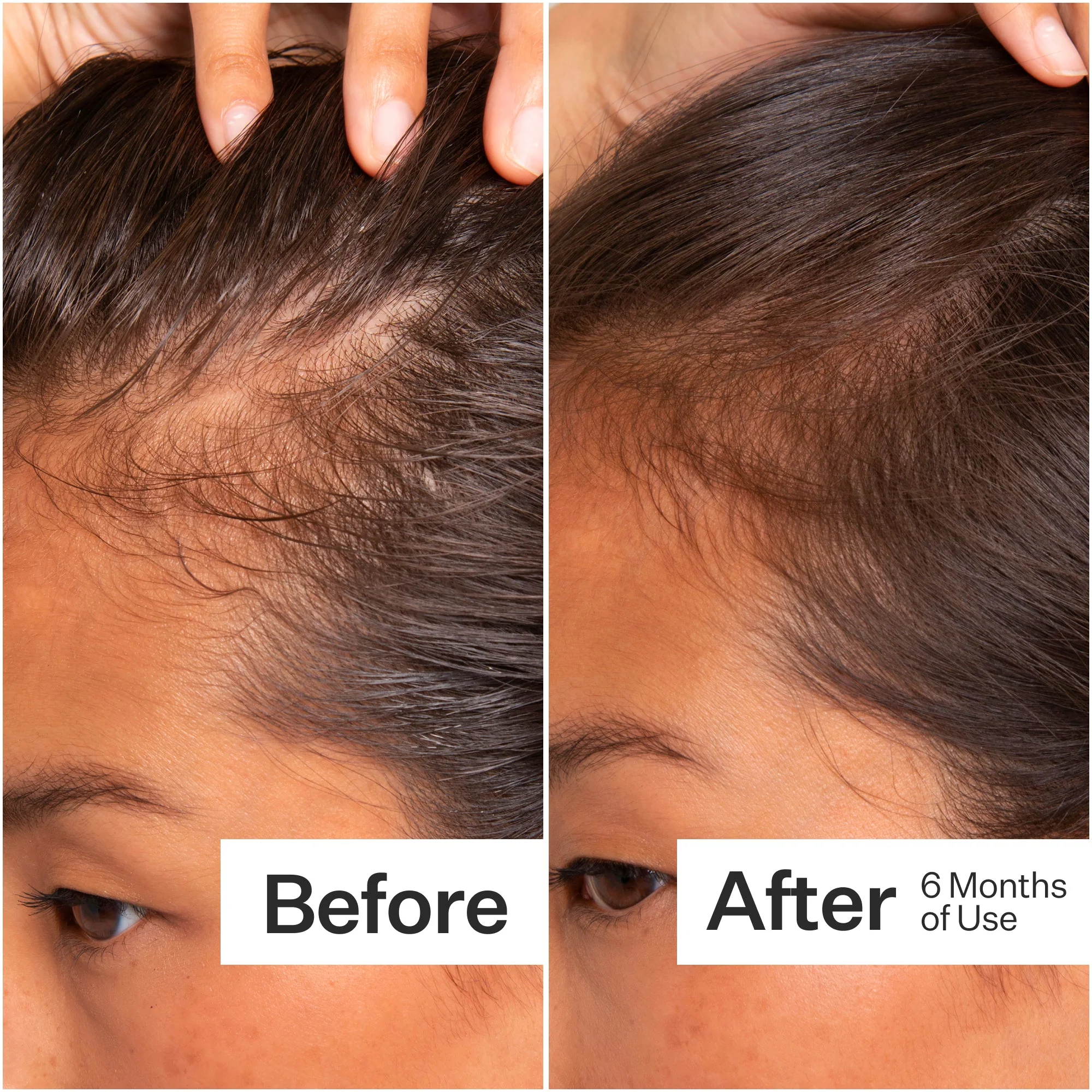 Stem Cell Scalp Serum for Thicker, Fuller Looking Hair - Image 6