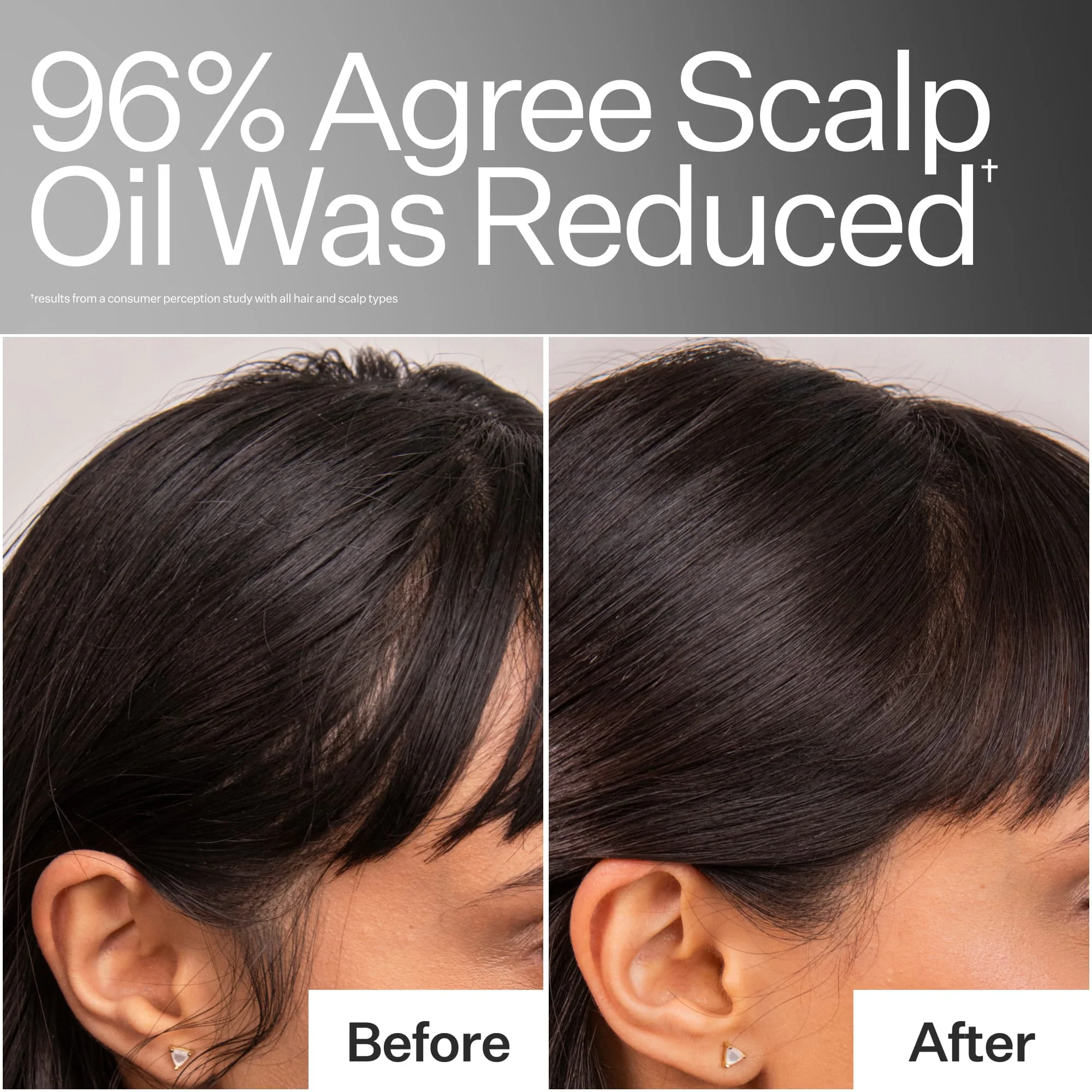 4% Niacinamide Oily Scalp Serum - Image 3