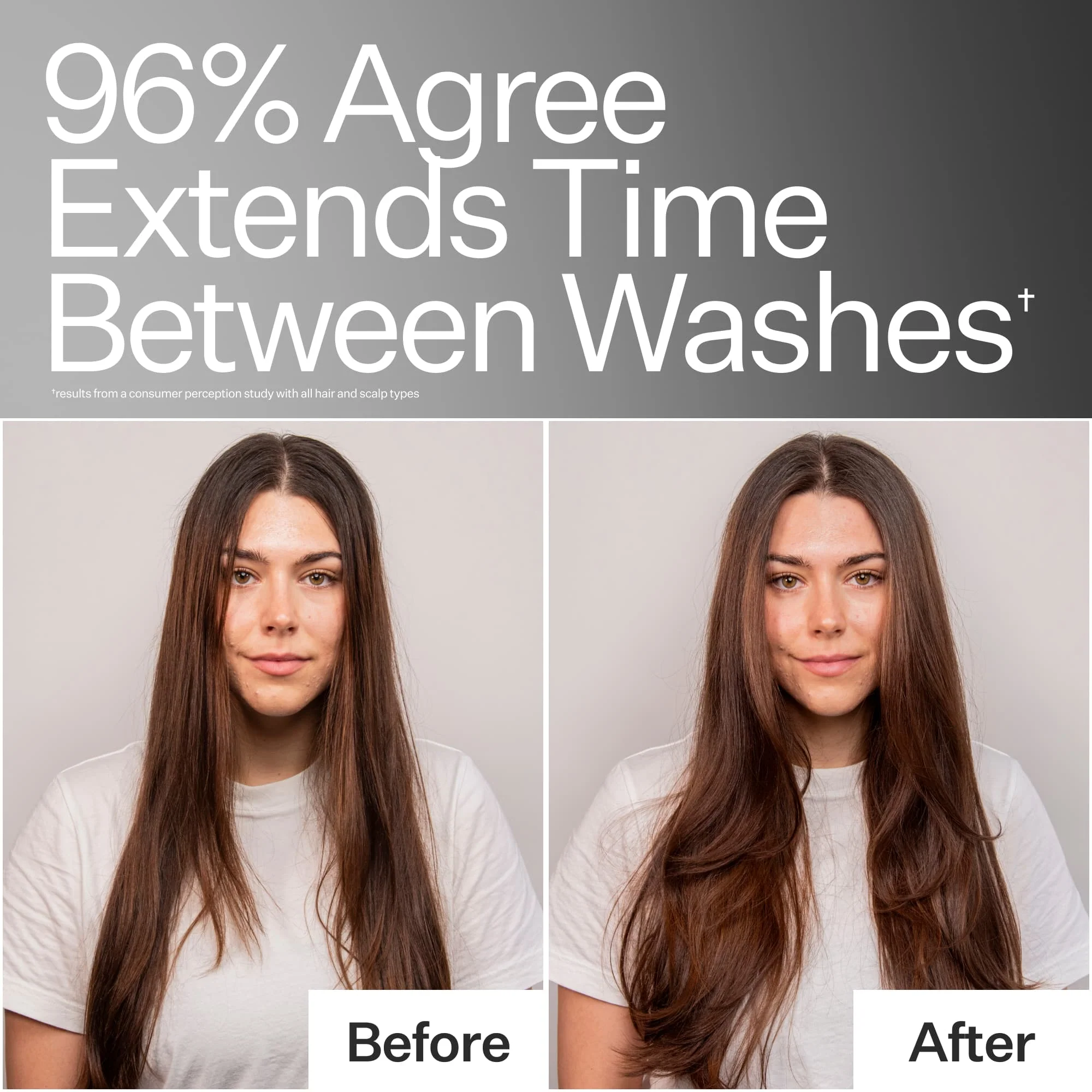 4% Niacinamide Oily Scalp Serum - Image 4