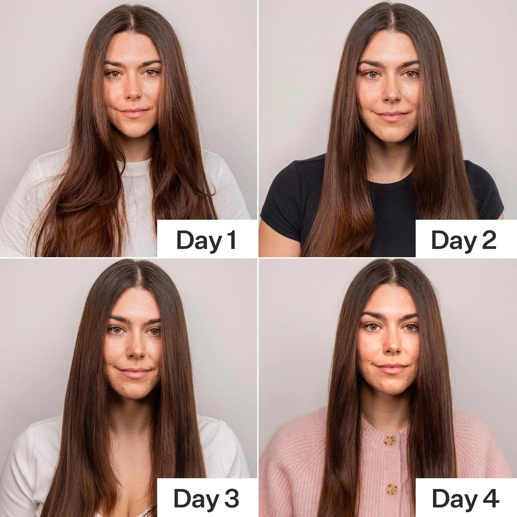 4% Niacinamide Oily Scalp Serum - Image 6