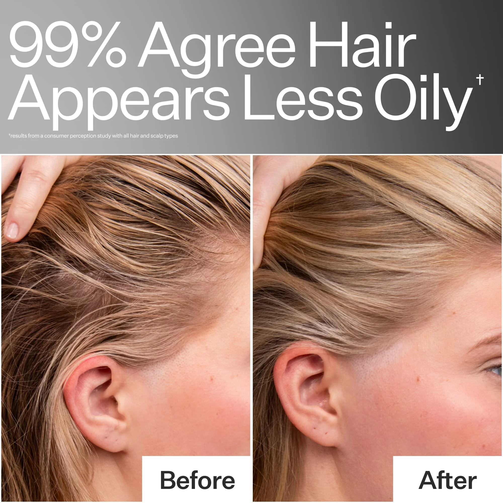 4% Niacinamide Oily Scalp Serum - Image 8