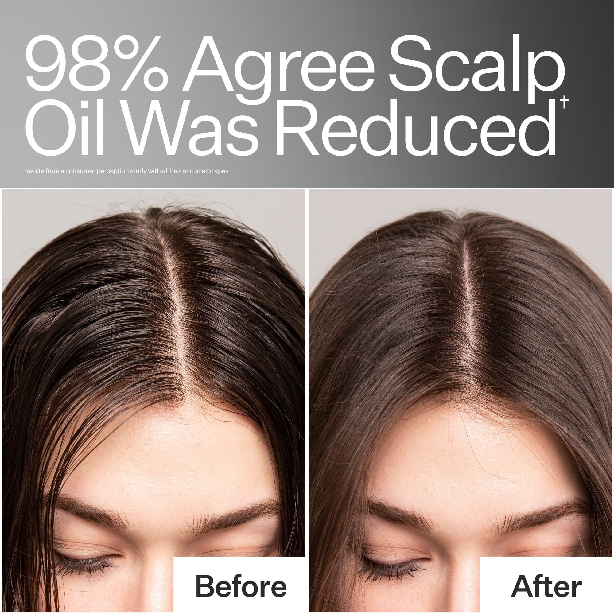 Oil Control Pro System - Image 7