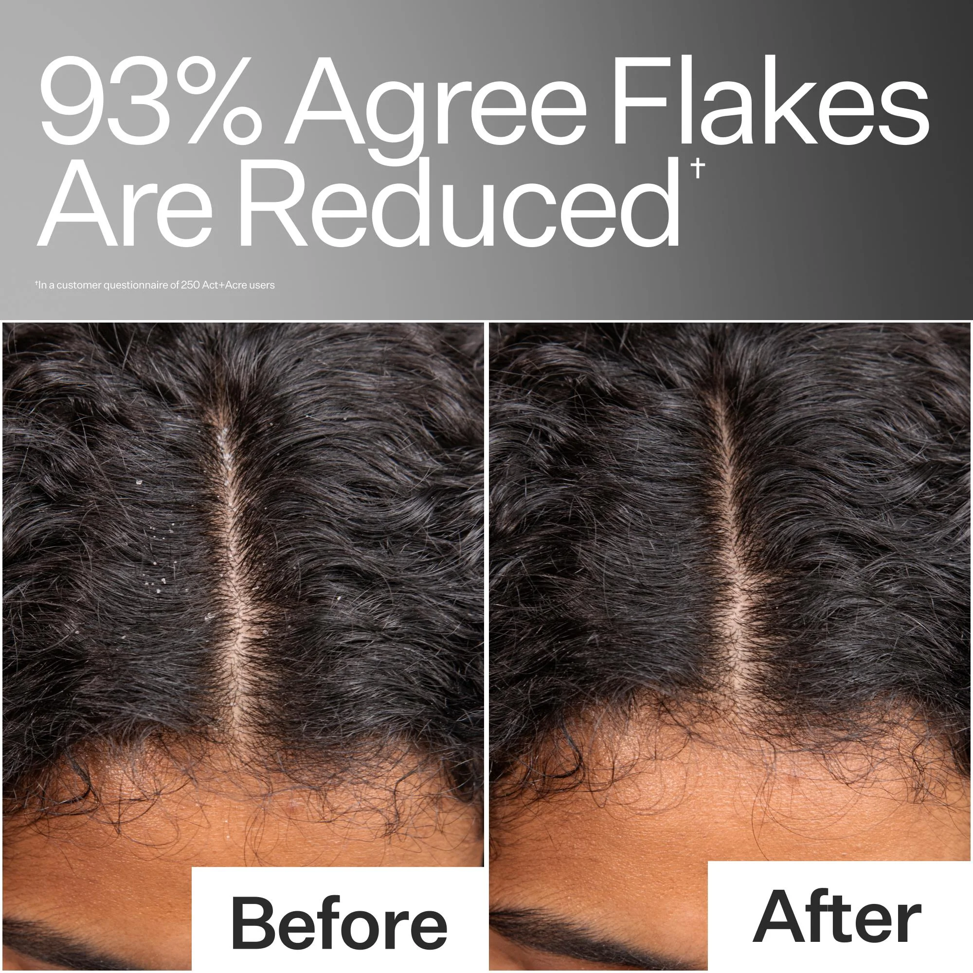 Scalp Relief System - Image 3