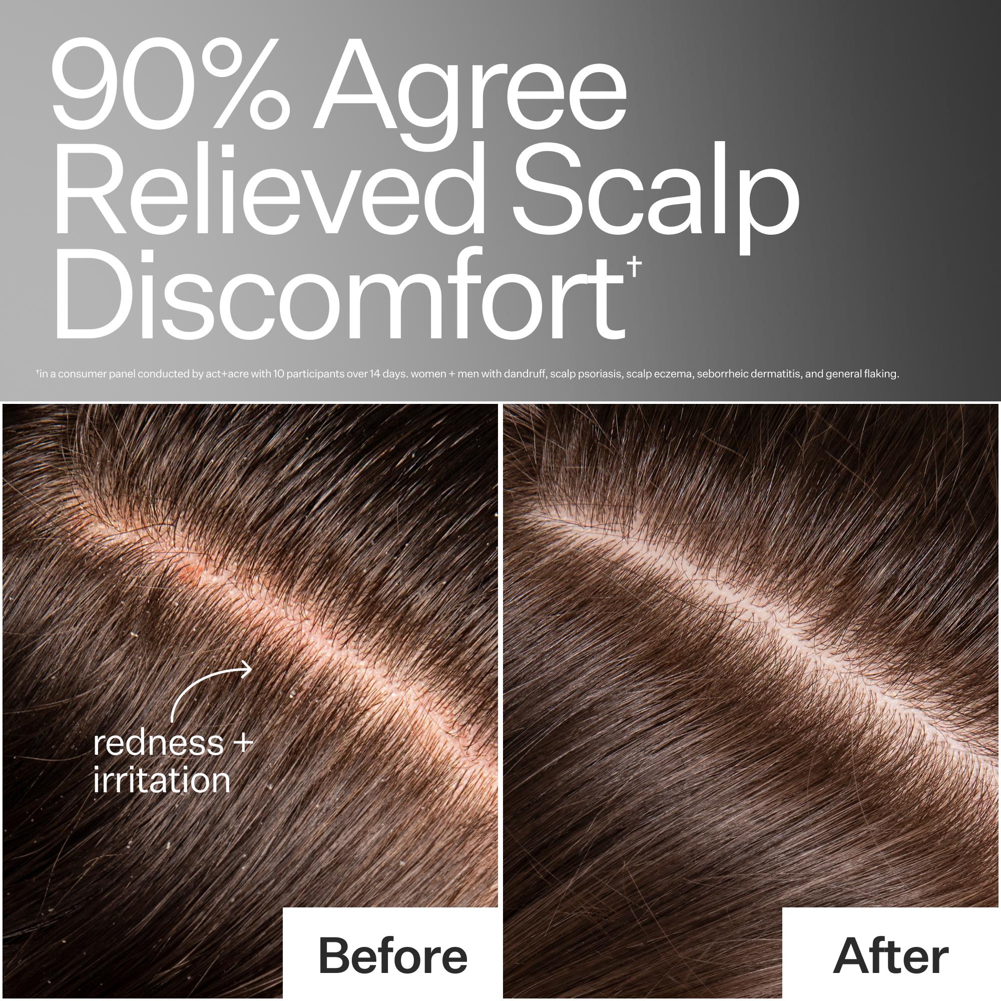 Scalp Relief System - Image 4