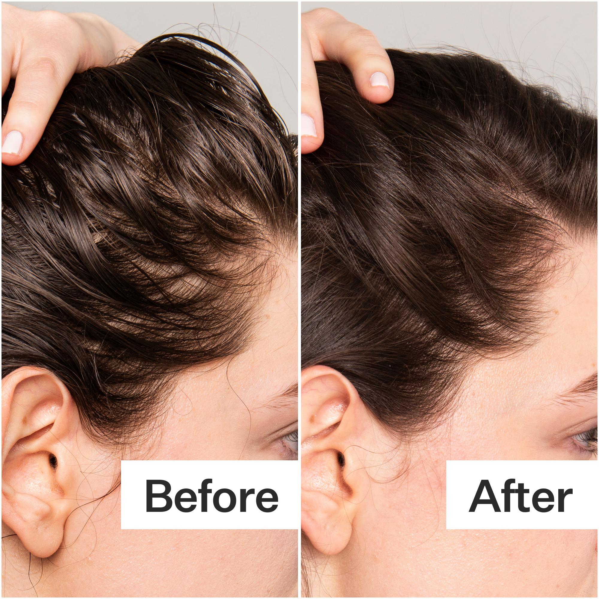 Salicylic Acid Scalp Exfoliator - Image 4
