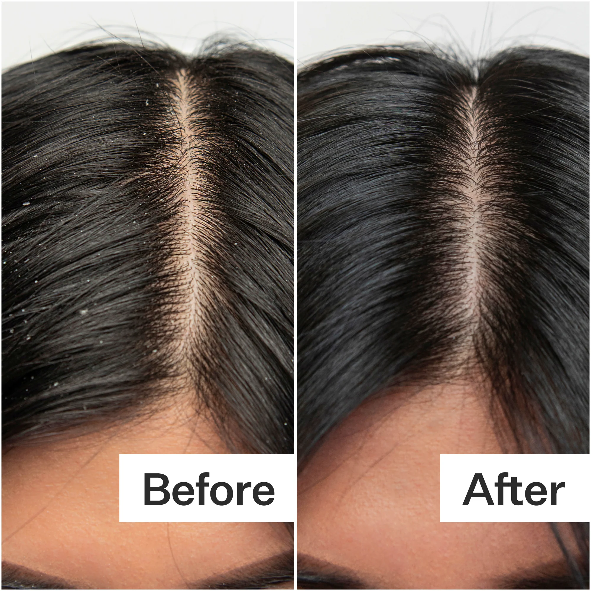 Salicylic Acid Scalp Exfoliator - Image 6