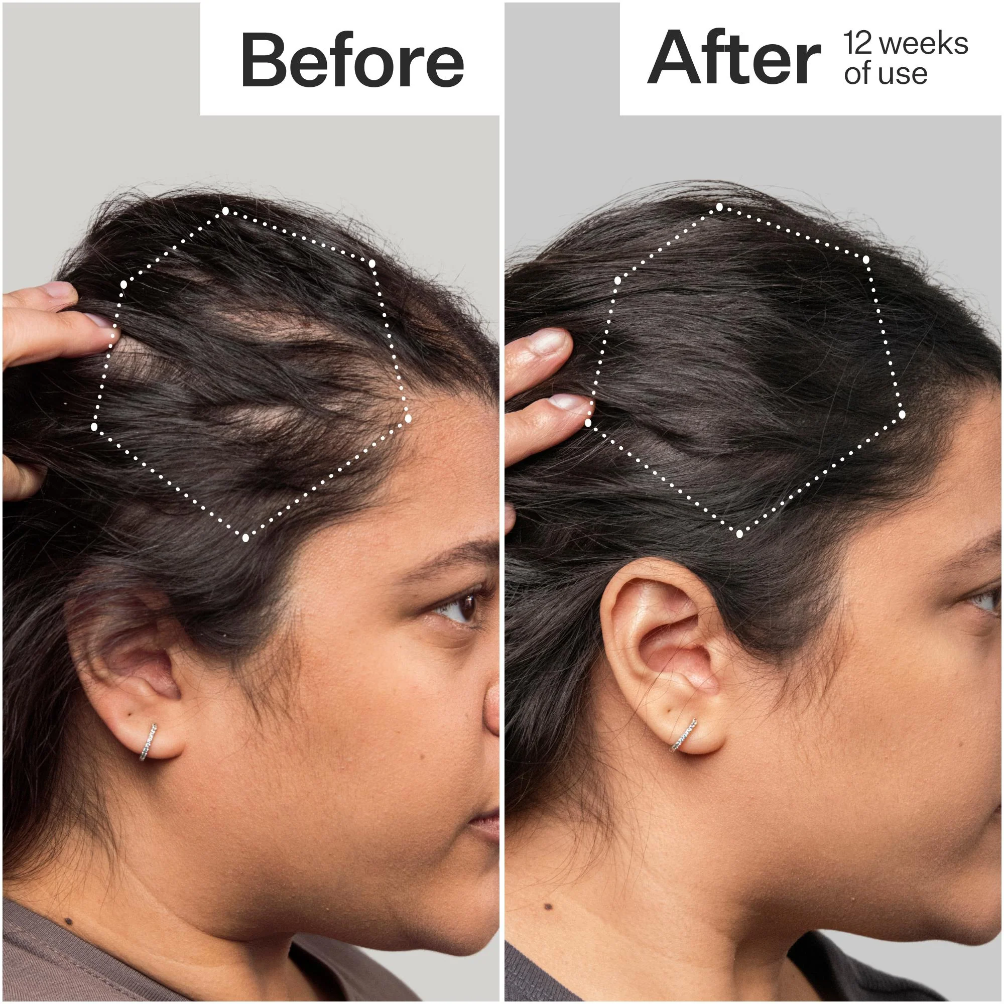 3% Stem Cell Peptide Treatment - Image 8