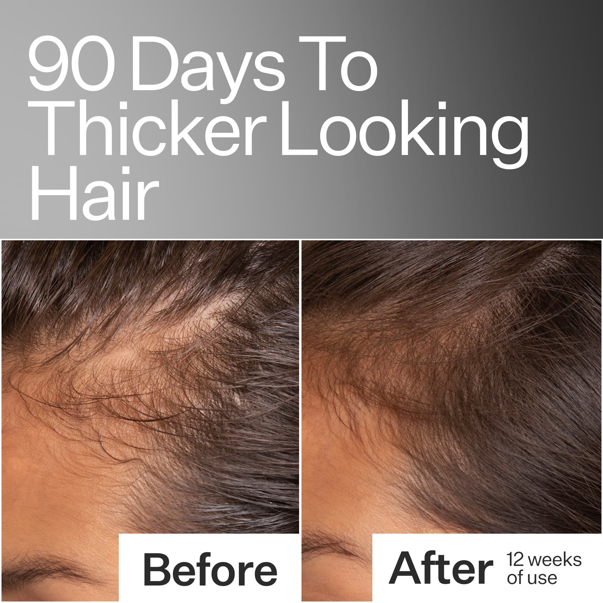 Thick + Full Hair System - Image 4